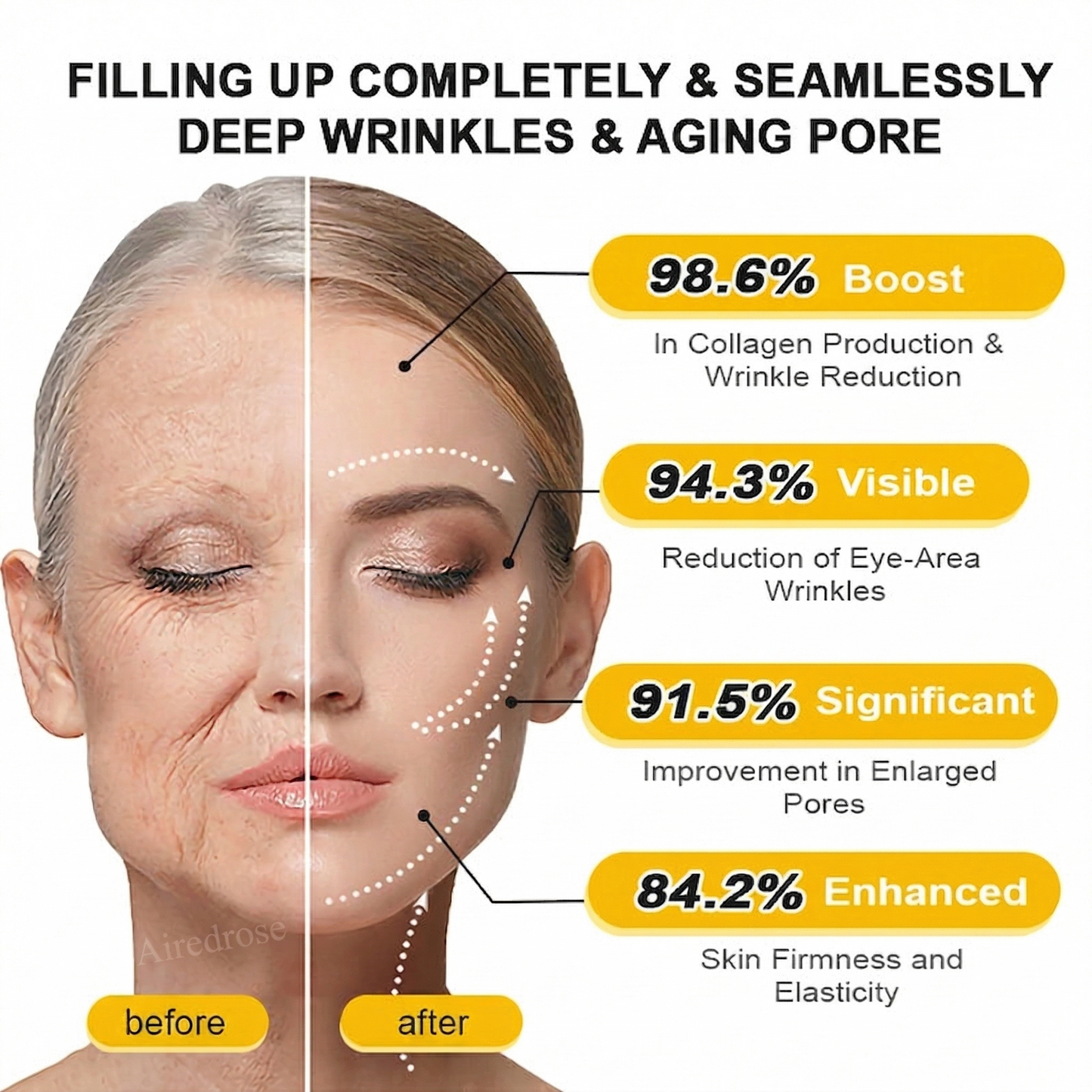 Wrinkle-Lift⬆️ Airedrose® Botox & Vita A Retinol Shot Tightening cream