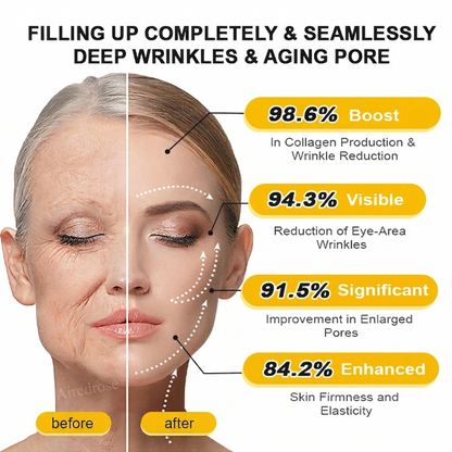 Wrinkle-Lift⬆️ Airedrose® Botox & Vita A Retinol Shot Tightening cream
