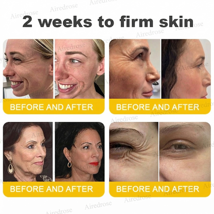 Wrinkle-Lift⬆️ Airedrose® Botox & Vita A Retinol Shot Tightening cream
