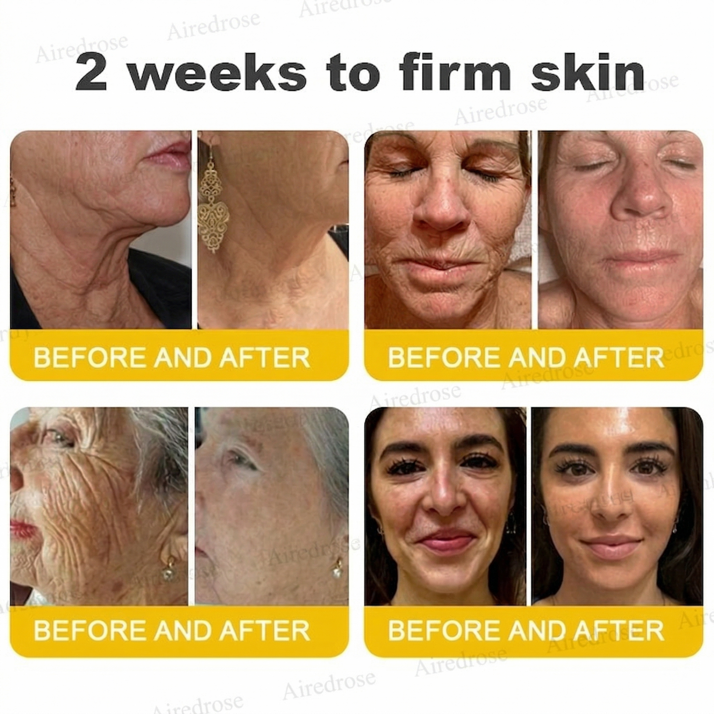 Wrinkle-Lift⬆️ Airedrose® Botox & Vita A Retinol Shot Tightening cream