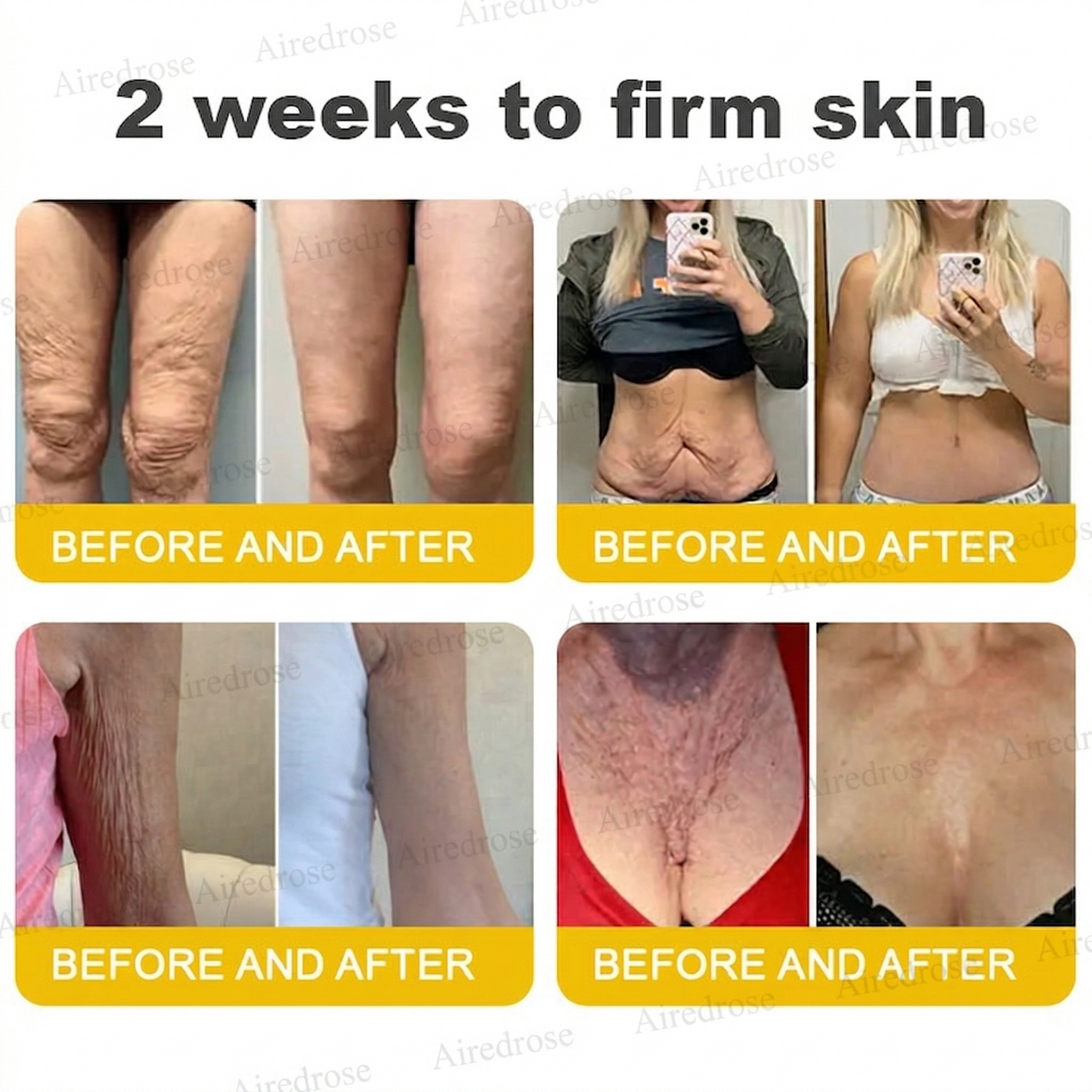 Wrinkle-Lift⬆️ Airedrose® Botox & Vita A Retinol Shot Tightening cream