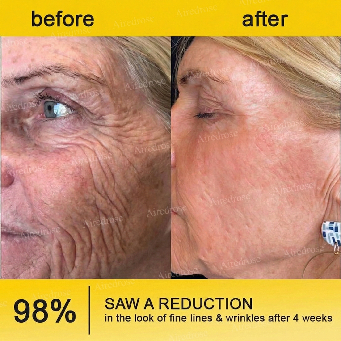 Wrinkle-Lift⬆️ Airedrose® Botox & Vita A Retinol Shot Tightening cream
